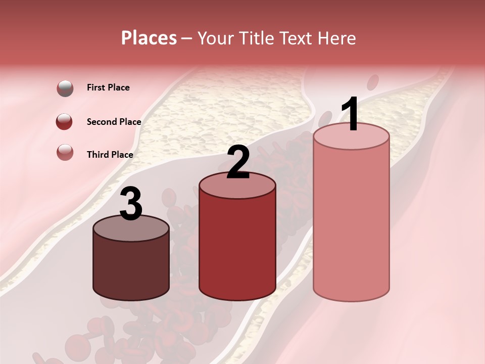 Sphygmomanometer Restenosis Cardiology PowerPoint Template