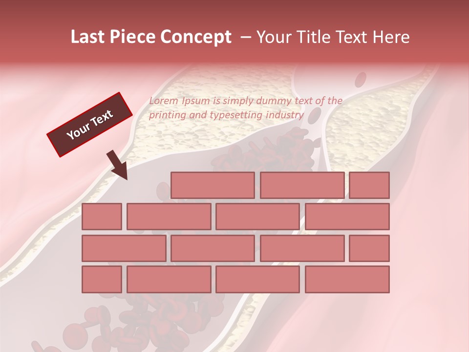 Sphygmomanometer Restenosis Cardiology PowerPoint Template