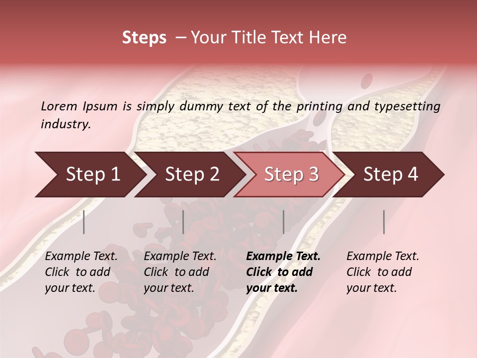 Sphygmomanometer Restenosis Cardiology PowerPoint Template