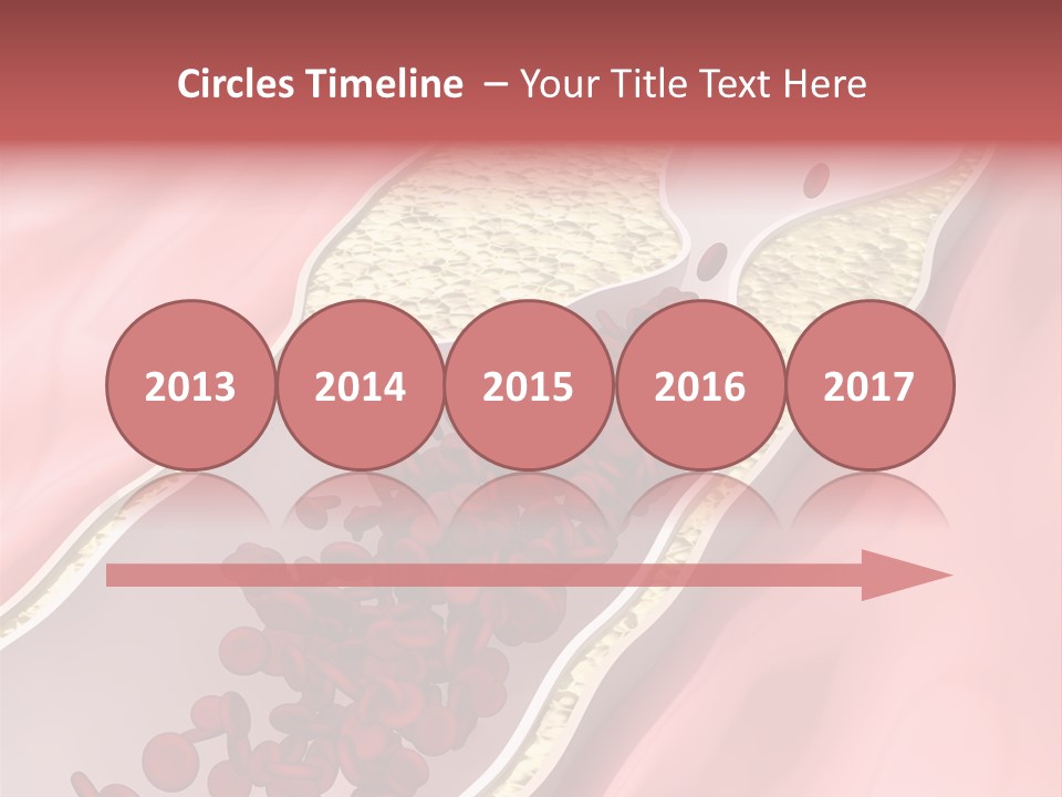 Sphygmomanometer Restenosis Cardiology PowerPoint Template