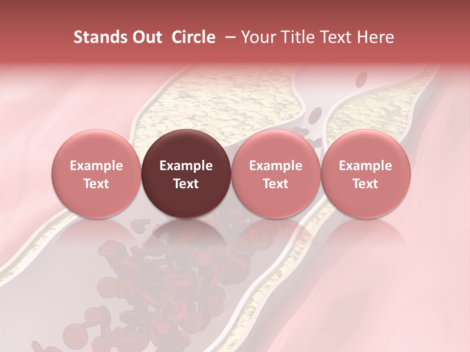 Sphygmomanometer Restenosis Cardiology PowerPoint Template