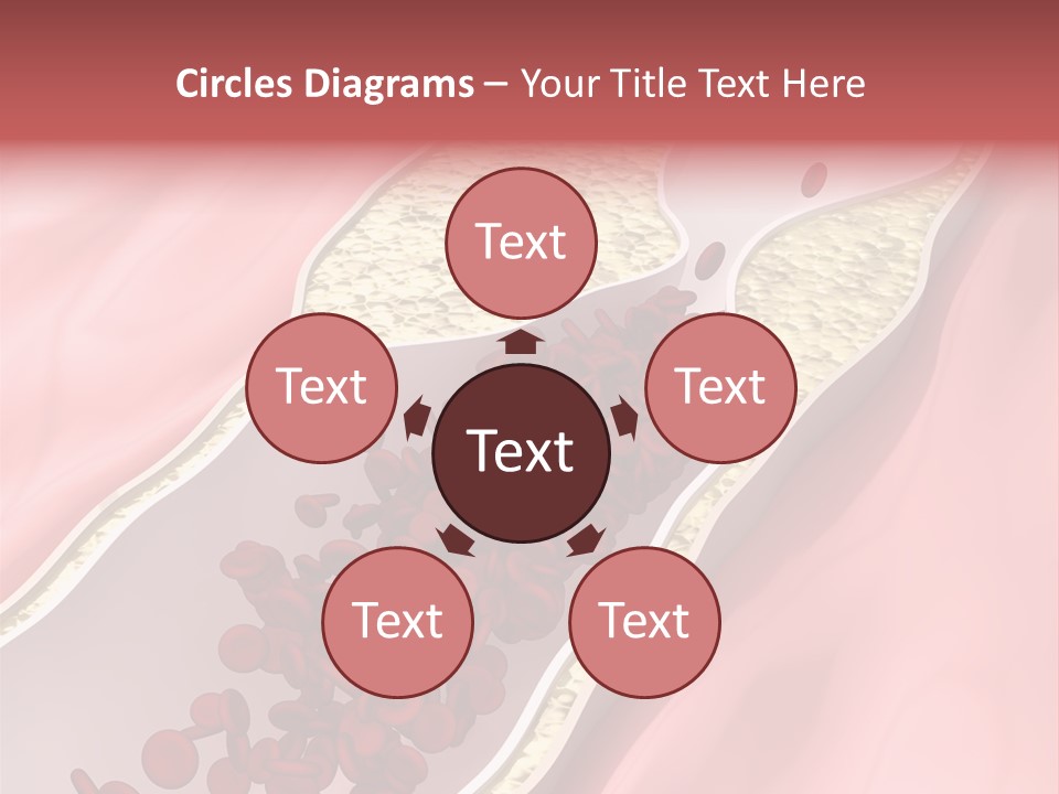 Sphygmomanometer Restenosis Cardiology PowerPoint Template