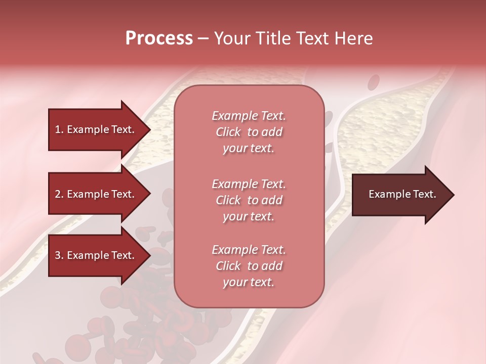 Sphygmomanometer Restenosis Cardiology PowerPoint Template