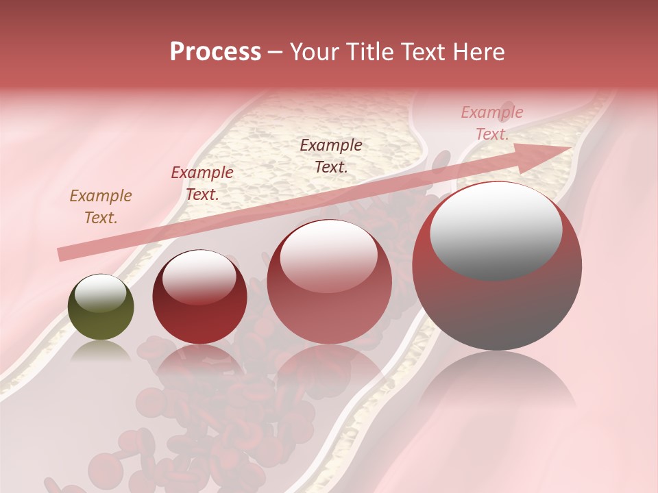 Sphygmomanometer Restenosis Cardiology PowerPoint Template