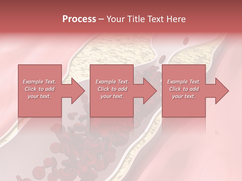Sphygmomanometer Restenosis Cardiology PowerPoint Template