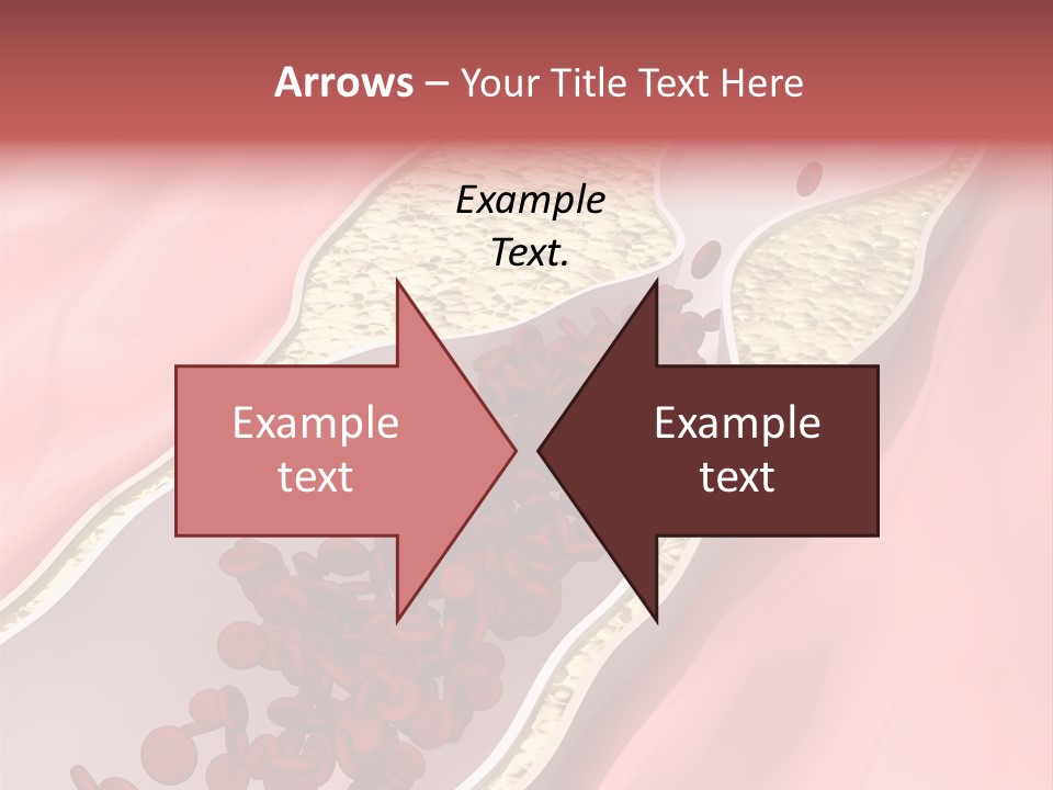 Sphygmomanometer Restenosis Cardiology PowerPoint Template