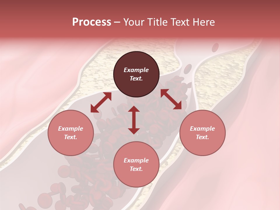 Sphygmomanometer Restenosis Cardiology PowerPoint Template