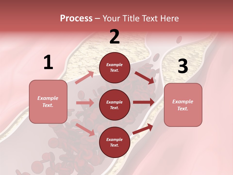 Sphygmomanometer Restenosis Cardiology PowerPoint Template