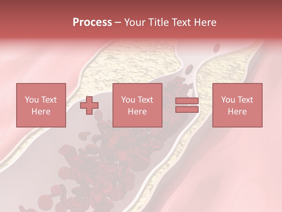Sphygmomanometer Restenosis Cardiology PowerPoint Template
