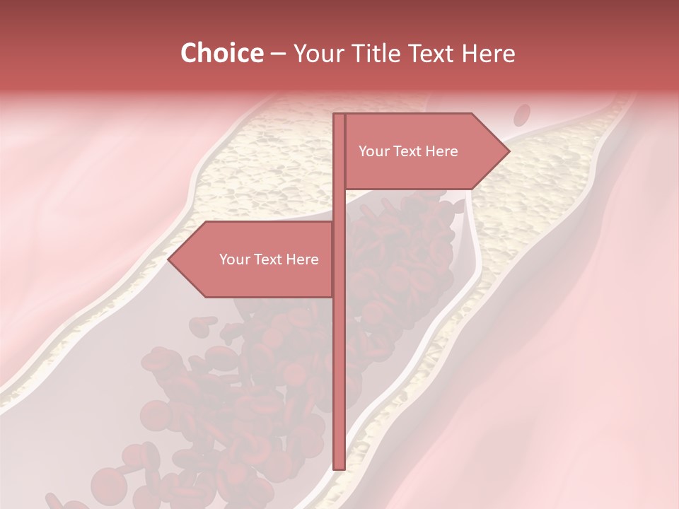 Sphygmomanometer Restenosis Cardiology PowerPoint Template