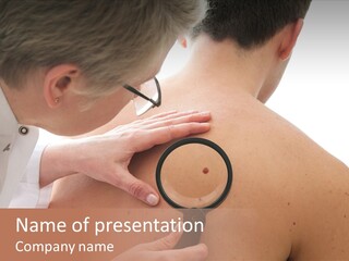 Physician Diagnosis Mole PowerPoint Template