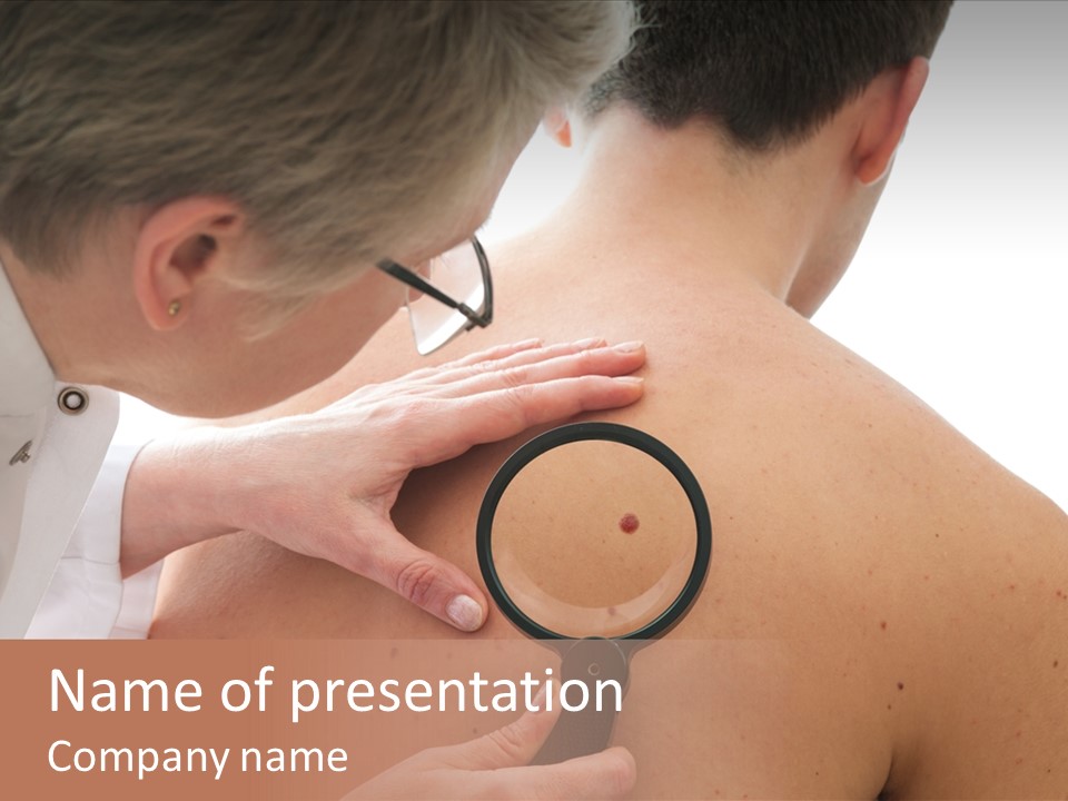 Physician Diagnosis Mole PowerPoint Template