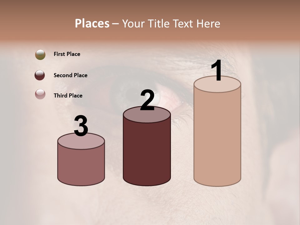 Stressed  Bacteria PowerPoint Template