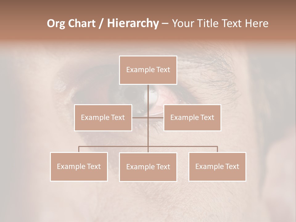 Stressed  Bacteria PowerPoint Template