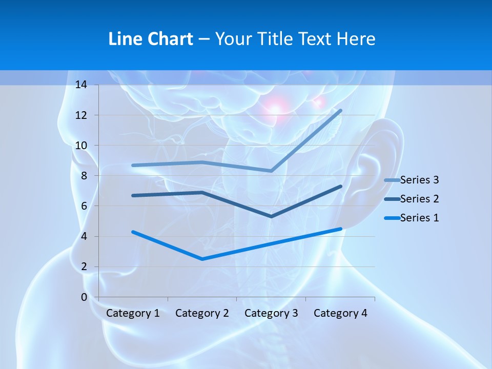 Highlighted Headache Skeletal PowerPoint Template