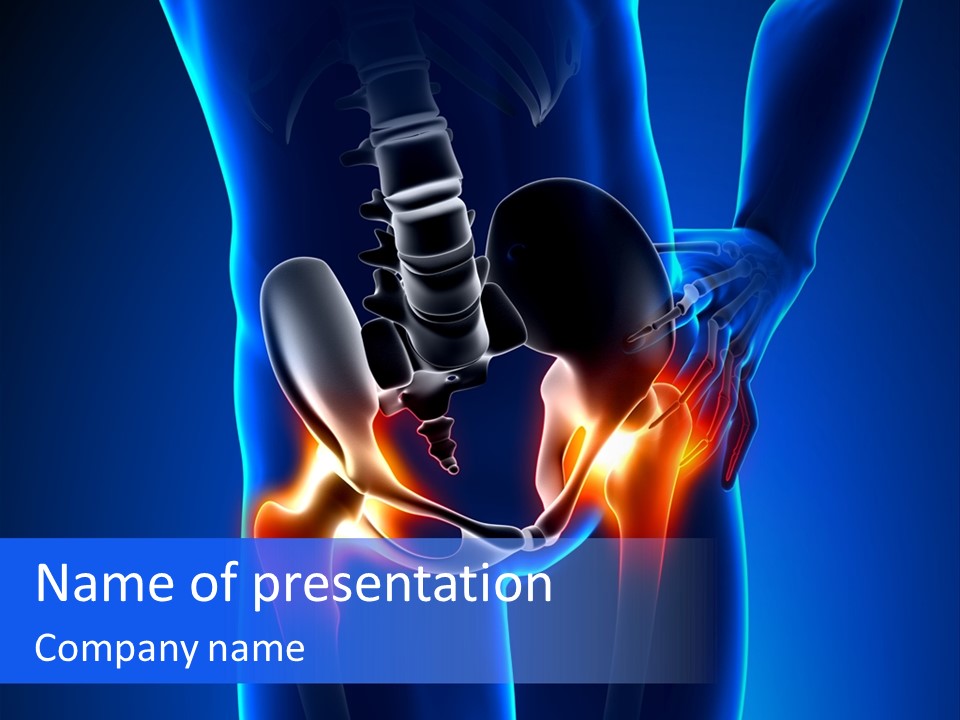 Leg Bone Medical PowerPoint Template