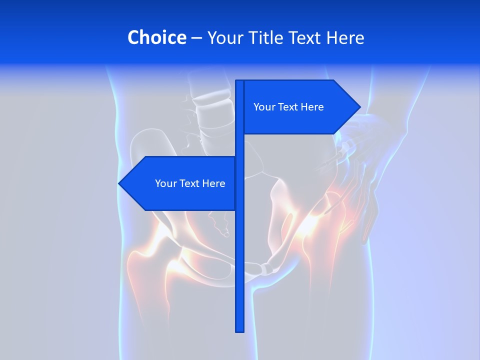 Leg Bone Medical PowerPoint Template