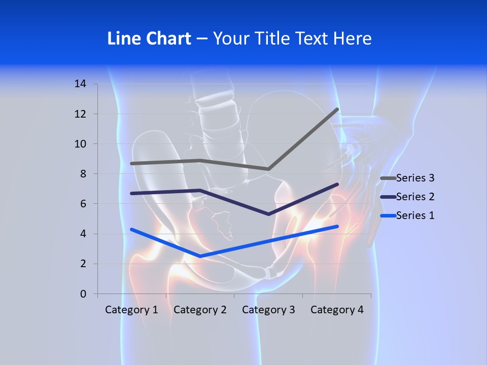 Leg Bone Medical PowerPoint Template