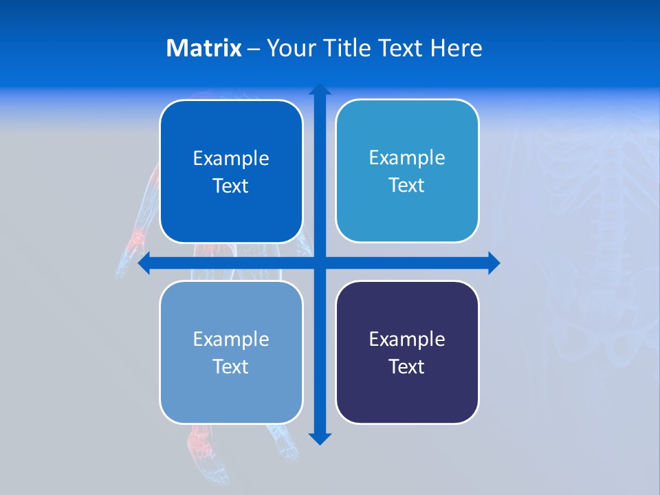 Ilium Painful Osteoporosis PowerPoint Template