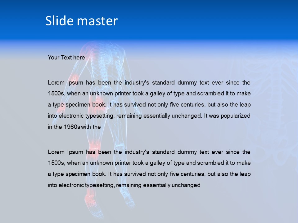 Ilium Painful Osteoporosis PowerPoint Template