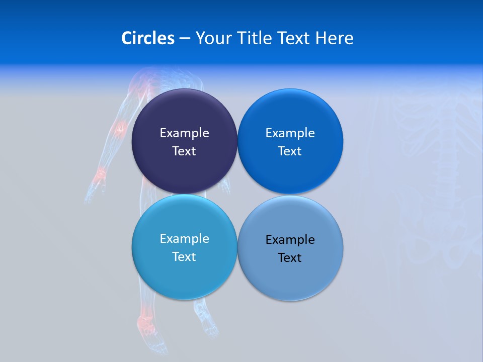 Ilium Painful Osteoporosis PowerPoint Template