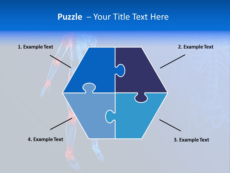 Ilium Painful Osteoporosis PowerPoint Template