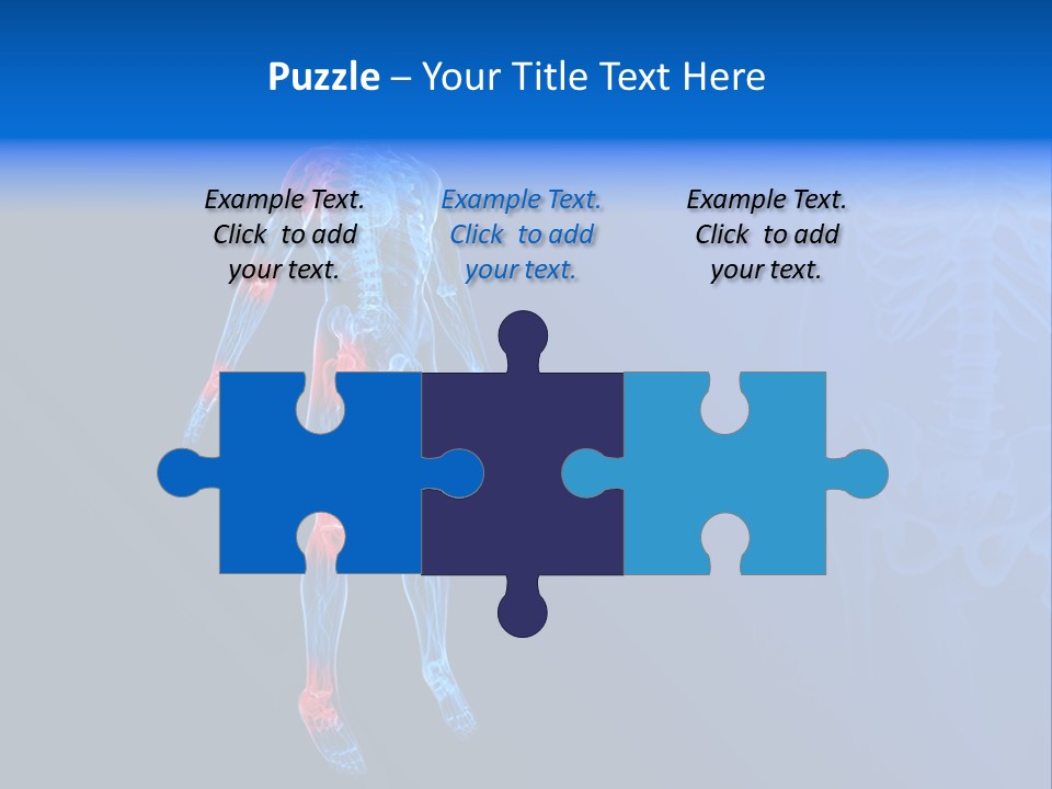 Ilium Painful Osteoporosis PowerPoint Template