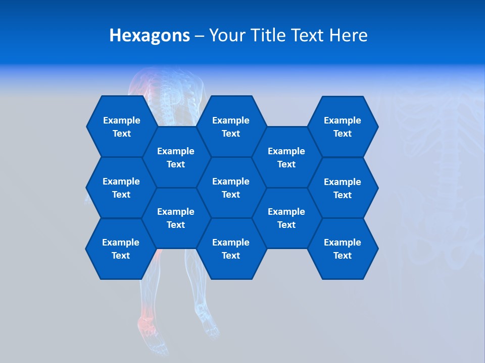 Ilium Painful Osteoporosis PowerPoint Template