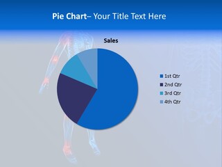 Ilium Painful Osteoporosis PowerPoint Template