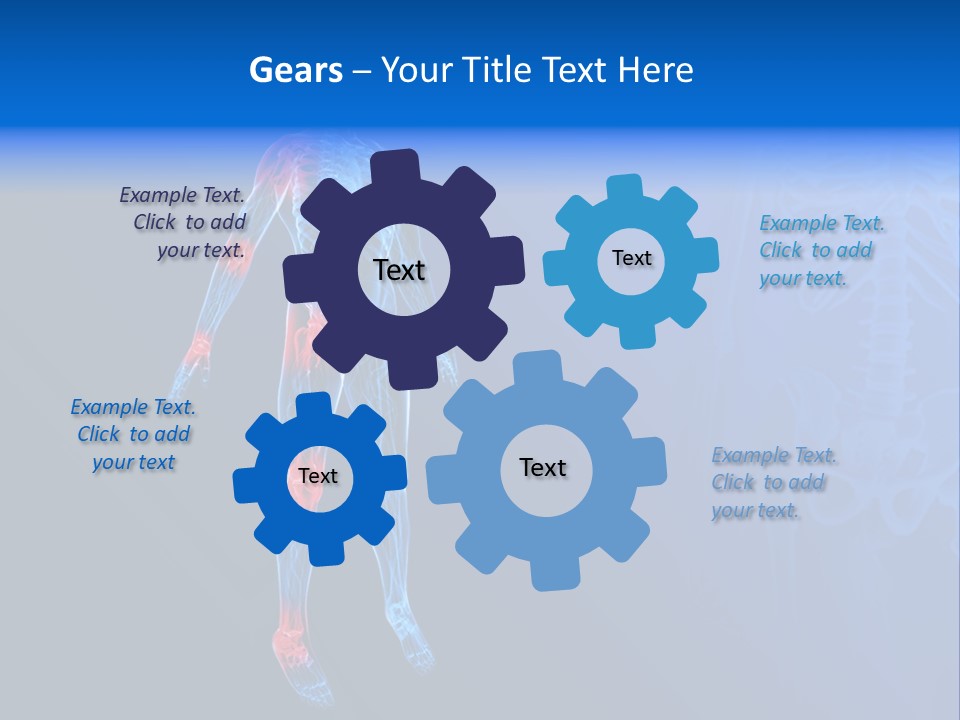Ilium Painful Osteoporosis PowerPoint Template