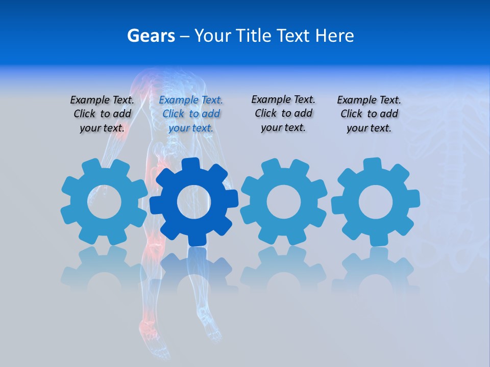 Ilium Painful Osteoporosis PowerPoint Template