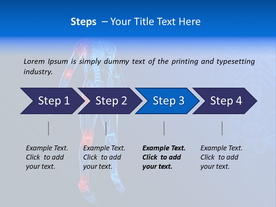Ilium Painful Osteoporosis PowerPoint Template