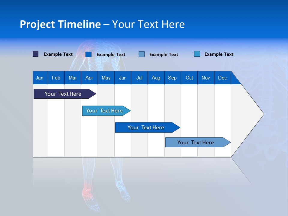 Ilium Painful Osteoporosis PowerPoint Template