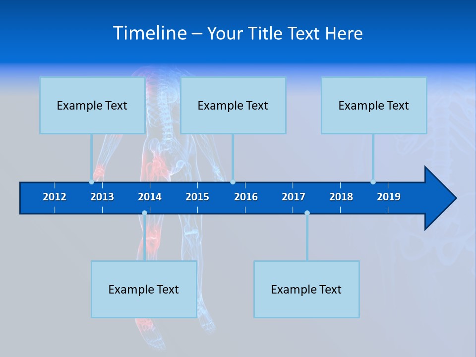 Ilium Painful Osteoporosis PowerPoint Template