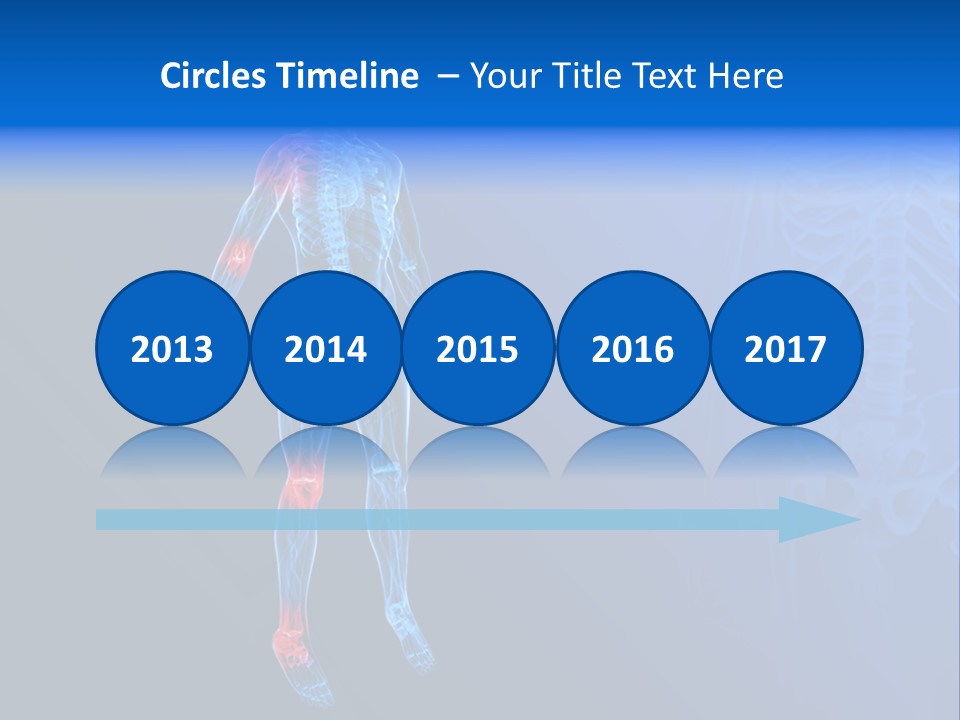 Ilium Painful Osteoporosis PowerPoint Template