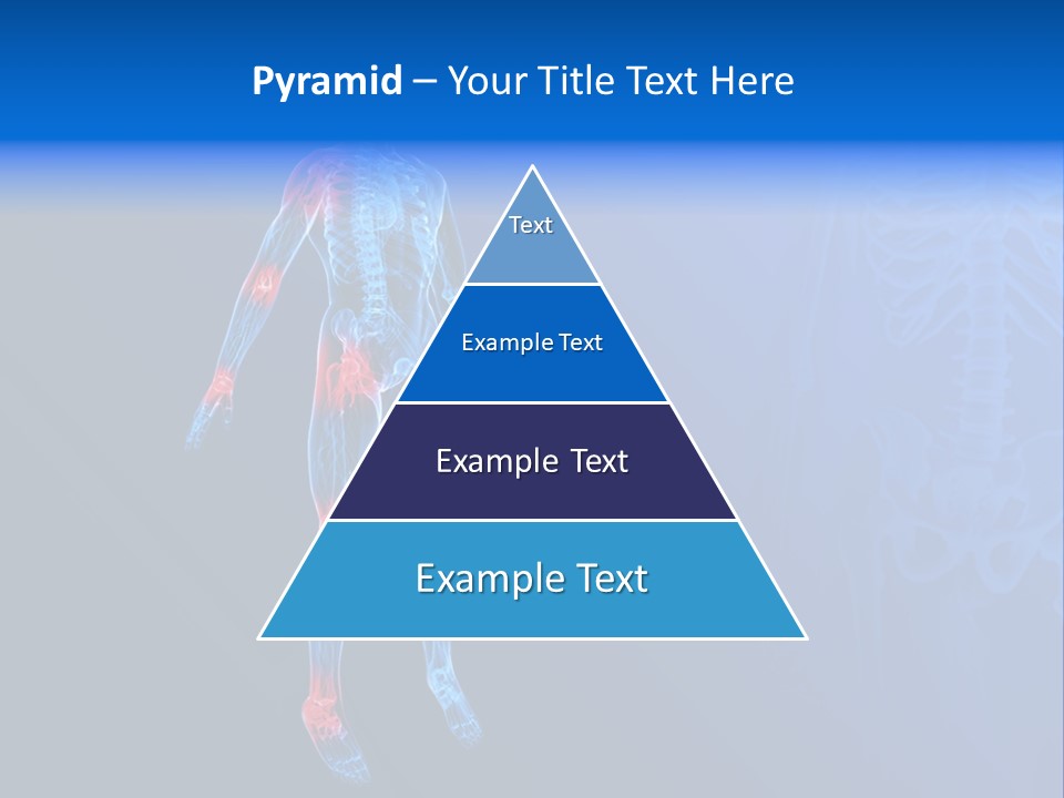 Ilium Painful Osteoporosis PowerPoint Template