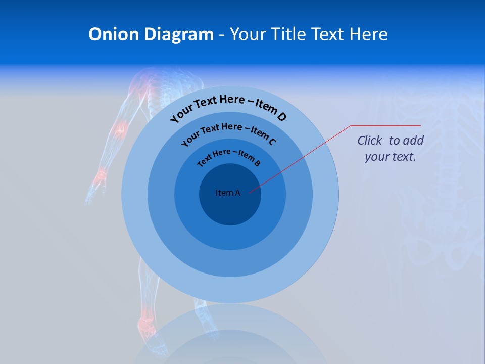 Ilium Painful Osteoporosis PowerPoint Template