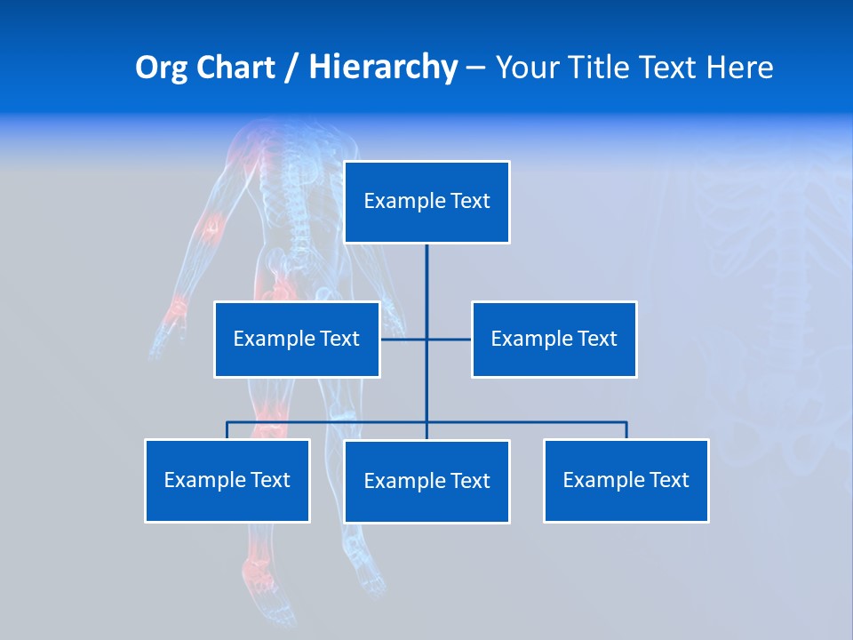 Ilium Painful Osteoporosis PowerPoint Template