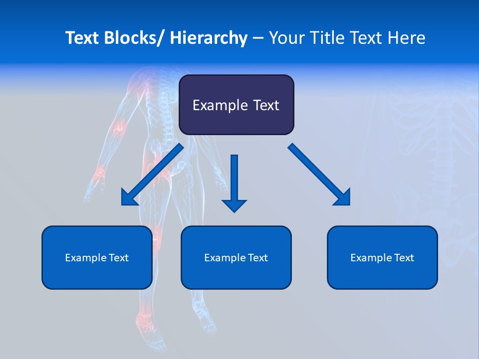 Ilium Painful Osteoporosis PowerPoint Template