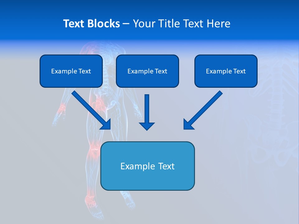 Ilium Painful Osteoporosis PowerPoint Template