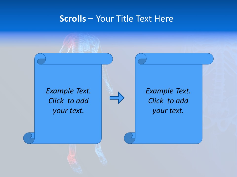 Ilium Painful Osteoporosis PowerPoint Template