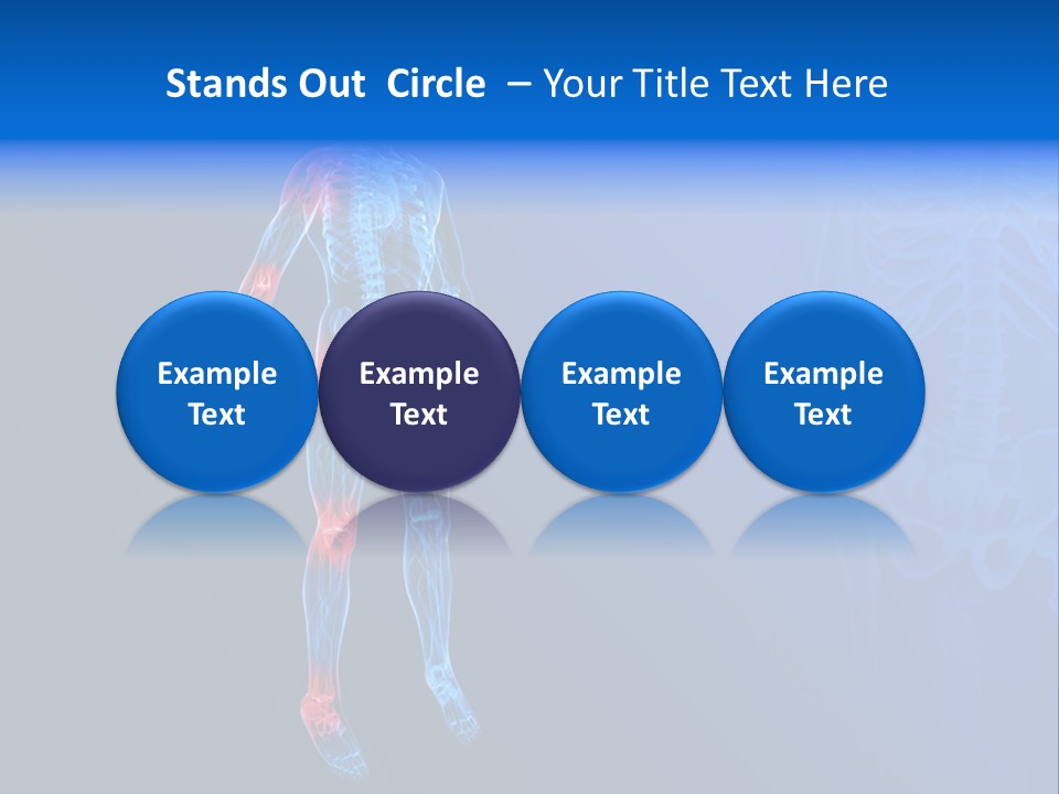 Ilium Painful Osteoporosis PowerPoint Template