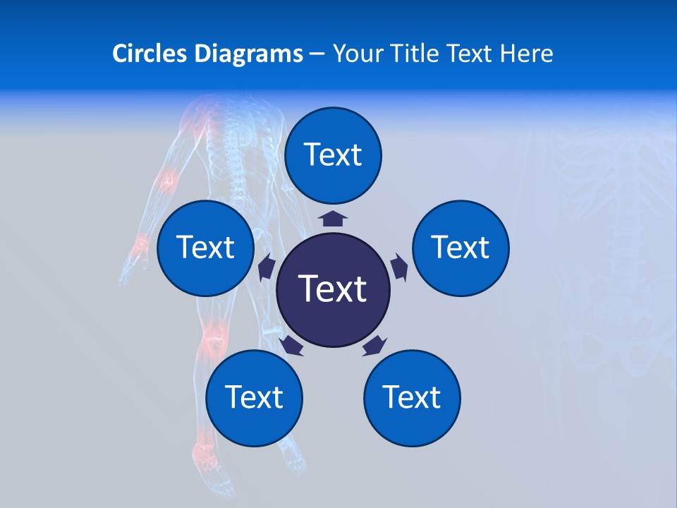 Ilium Painful Osteoporosis PowerPoint Template