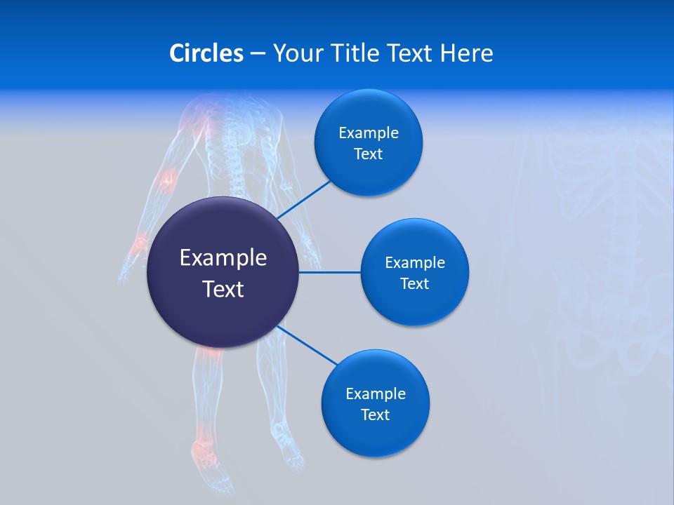 Ilium Painful Osteoporosis PowerPoint Template