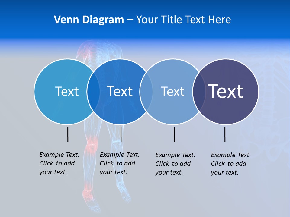Ilium Painful Osteoporosis PowerPoint Template