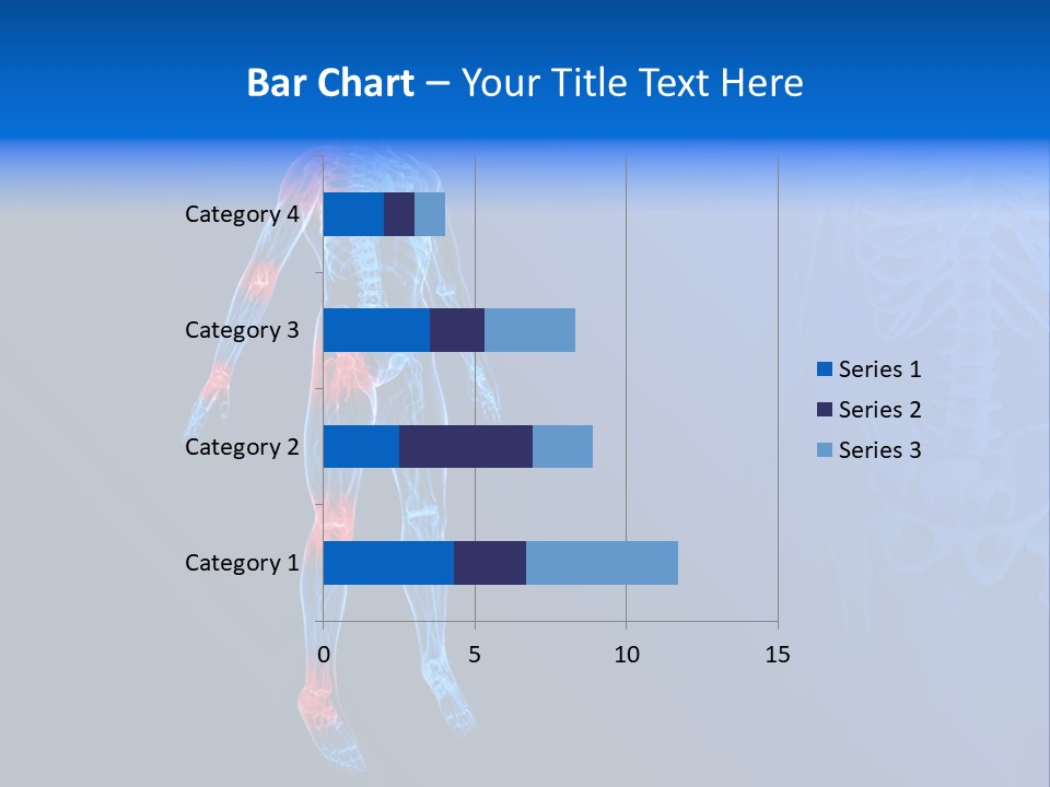 Ilium Painful Osteoporosis PowerPoint Template