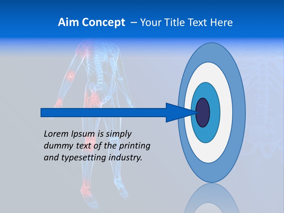 Ilium Painful Osteoporosis PowerPoint Template
