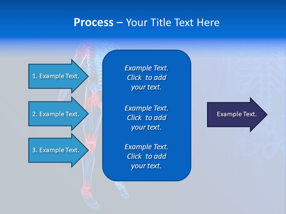 Ilium Painful Osteoporosis PowerPoint Template