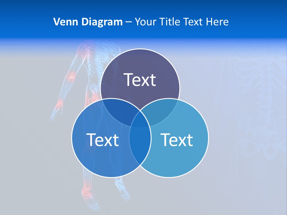 Ilium Painful Osteoporosis PowerPoint Template
