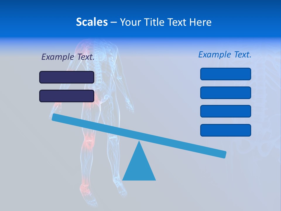 Ilium Painful Osteoporosis PowerPoint Template